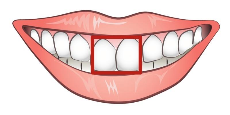 从牙齿看你性格特征 从牙齿看人的性格命运_4,上下牙齿都很小的