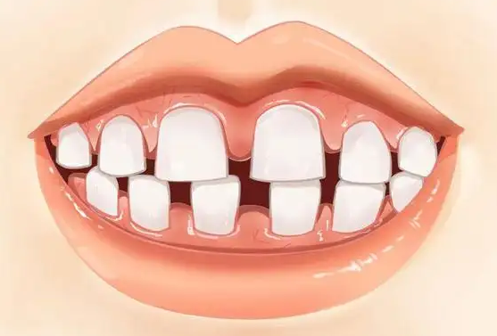 如果女人门牙有缝旺夫吗大牙齿的女人其性格直率