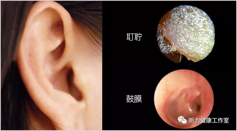 （李向东）耳型相术图解大全，你有吗？